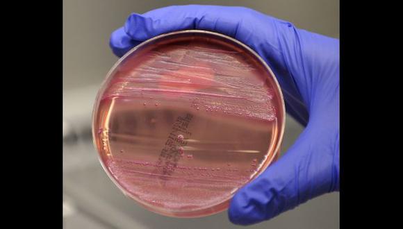 EE.UU.: hallan bacteria mortal en el exterior de un laboratorio