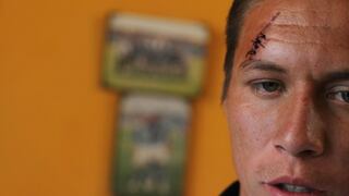 Así se ve Martín Dallo’rso después de la brutal agresión que recibió en la Copa Perú [FOTOS]