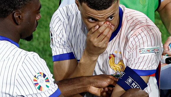 Kylian Mbappé se fracturó la nariz durante el partido entre Francia y Austria por la Eurocopa 2024. (Foto: AFP)
