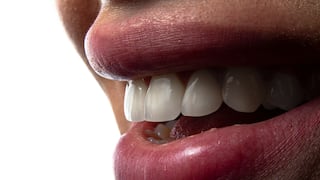 ¿Pueden los dientes volver a crecer? Los científicos creen que sí y están camino a logralo