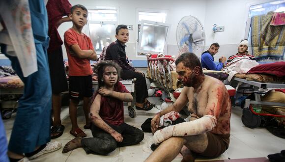 Una niña herida y un hombre esperan tratamiento en la sala de emergencias del hospital Al-Shifa tras un ataque israelí en la ciudad de Gaza el 5 de noviembre de 2023. (Foto de Bashar TALEB / AFP).