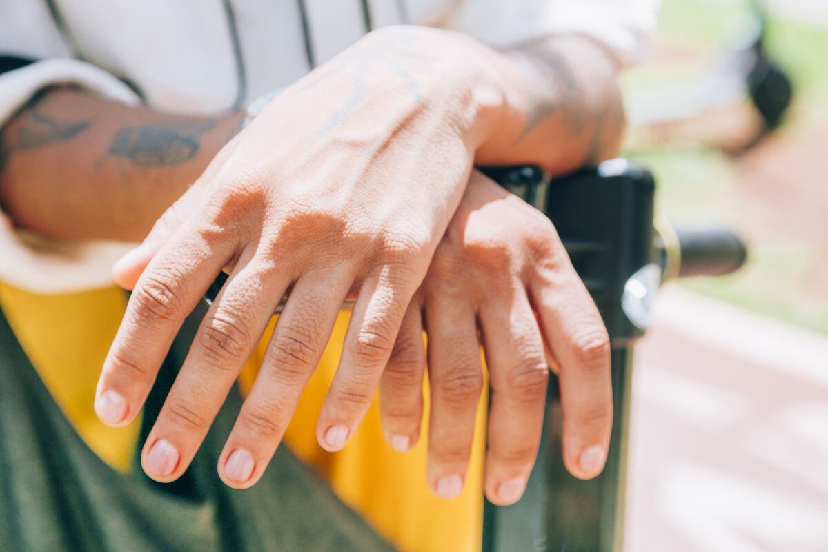 El pavimento, los juegos infantiles y otras superficies alcanzan altas temperaturas que si se rozan dichas superficies, podrías sufrir un grave accidente. (Foto: Freepik)