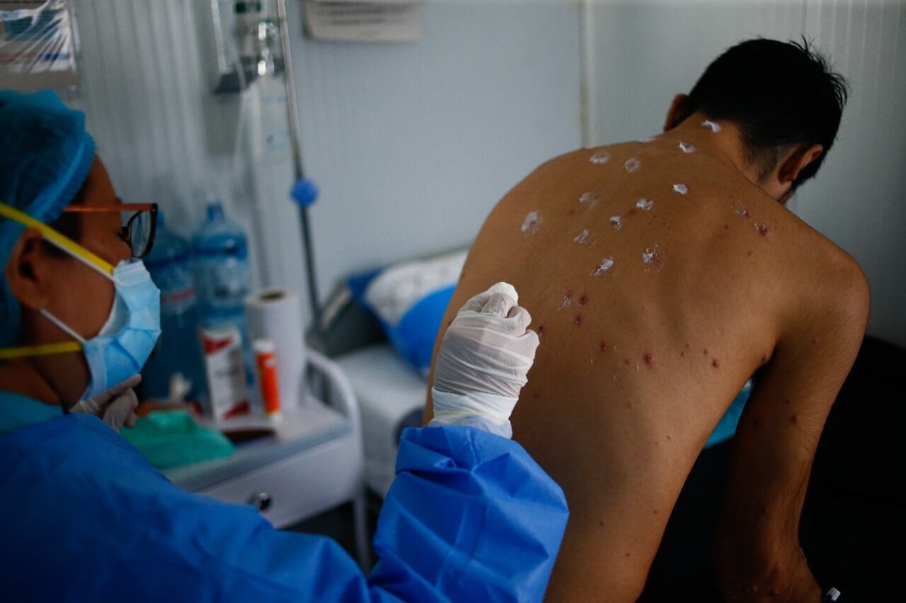Paciente del Hospital Cayetano Heredia.
Foto: Hugo Curotto