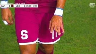 Fuertes imágenes: la impactante lesión en el dedo de jugador de Saprissa en Costa Rica | VIDEO