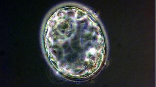 Implantarán células madre en fetos para tratar rara enfermedad
