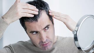 Caída del cabello: Tratamientos efectivos para evitarlo