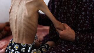 ¿Por qué se declaró hambruna en Gaza? Claves para entender esta catástrofe anunciada desde hace meses