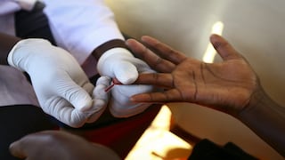 Brasil aprovecha el Mundial para realizar exámenes de VIH