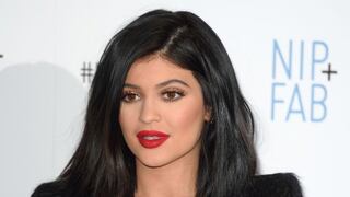 Kylie Jenner confiesa haberse puesto bótox en los labios