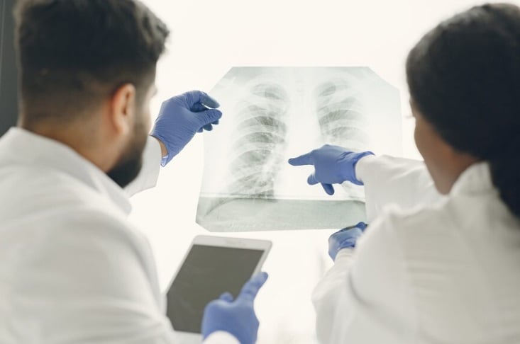 Aunque el cáncer de pulmón suele estar relacionado con el tabaquismo, hasta un 20% de los casos se da en personas que nunca han fumado. (Foto referencial: Freepik)