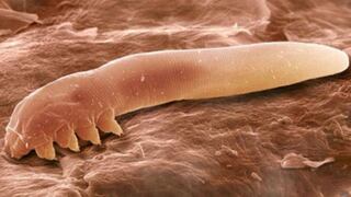 Estos ácaros microscópicos viven en nuestra cara