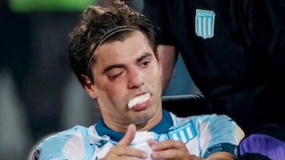 Baja sensible en Racing: Santi Sosa sufre fractura de maxilar tras codazo de Marcos Rojo, su propio compañero