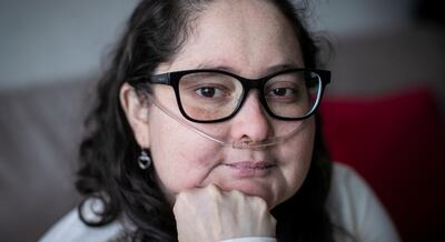 “Necesito vivir por mis hijas, le pido a Dios poder verlas crecer”: la dura lucha de Lourdes Castañeda tras ser diagnosticada con lupus