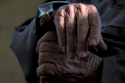 Japón inicia un pionero tratamiento de Parkinson con células madre