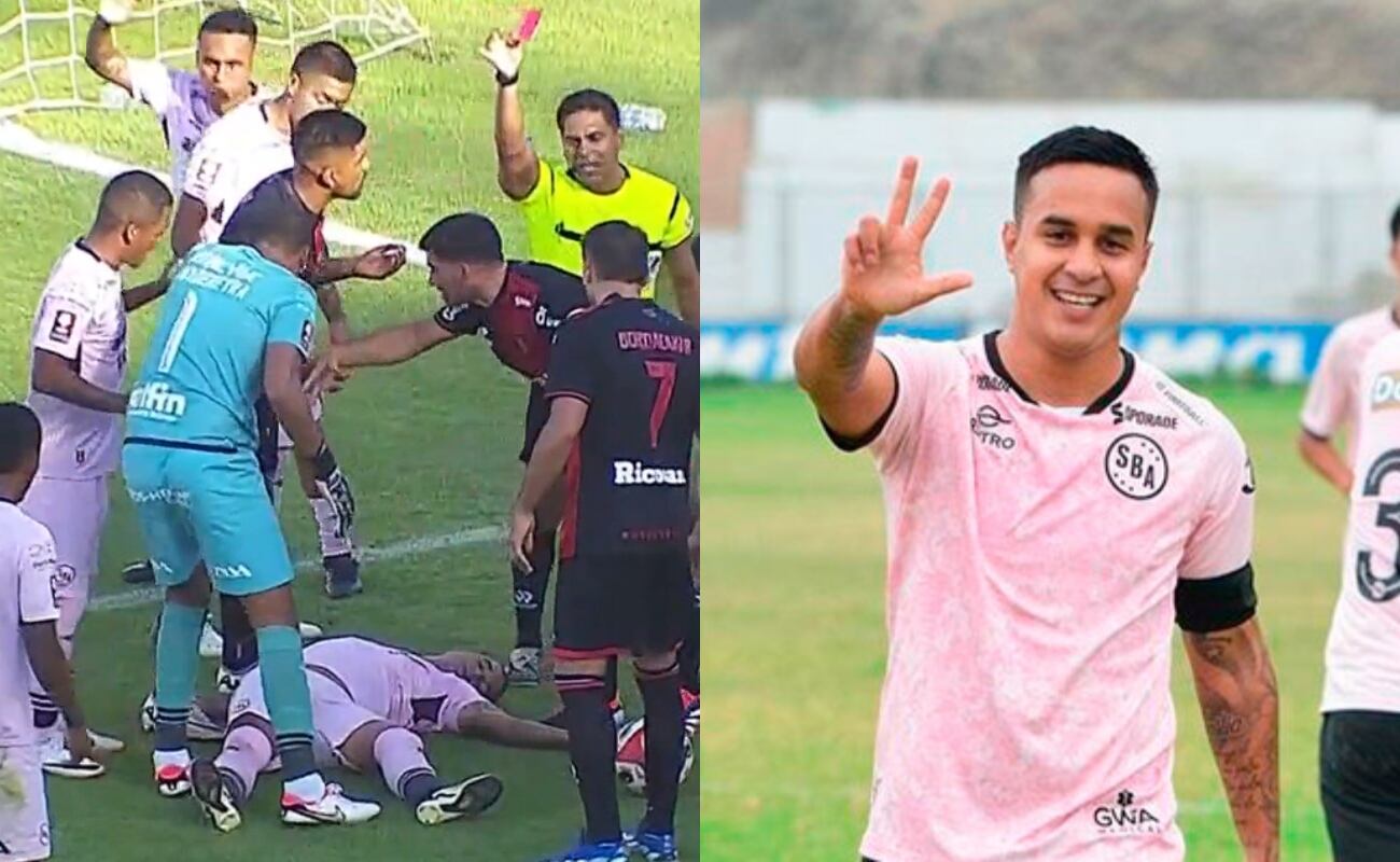 Qué se sabe de Jesús Barco tras el golpe que recibió en el Sport Boys vs Melgar