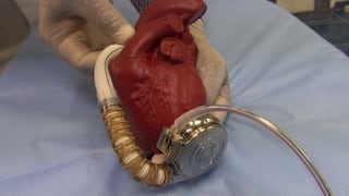 Este moderno corazón artificial salva a pacientes terminales