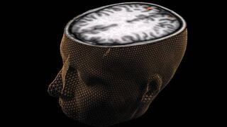 Científicos descubren zona del cerebro que ayudaría a predecir crímenes