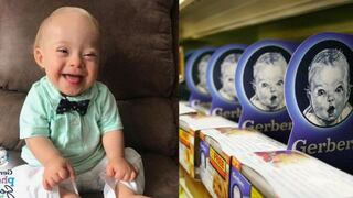 LucasWarren, el primer bebe con síndrome de down imagen de Gerber