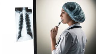 Cáncer de pulmón: ¿qué avances existen sobre su diagnóstico temprano?