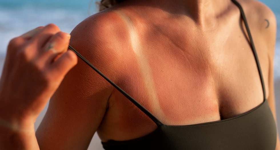 "Ya sea en una cama de bronceado o al sol, ese brillo 'saludable' que estás obteniendo es en realidad evidencia de que la radiación ultravioleta está dañando tu piel".