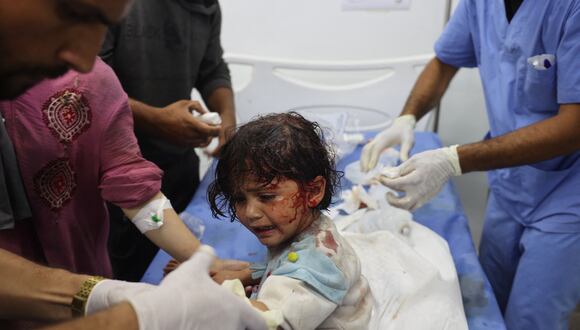 Una niña palestina, herida en un ataque de Israel contra un campo para desplazados de Gaza, recibe tratamiento en un hospital de Rafah el 26 de mayo de 2024. (Foto de Eyad BABA / AFP).