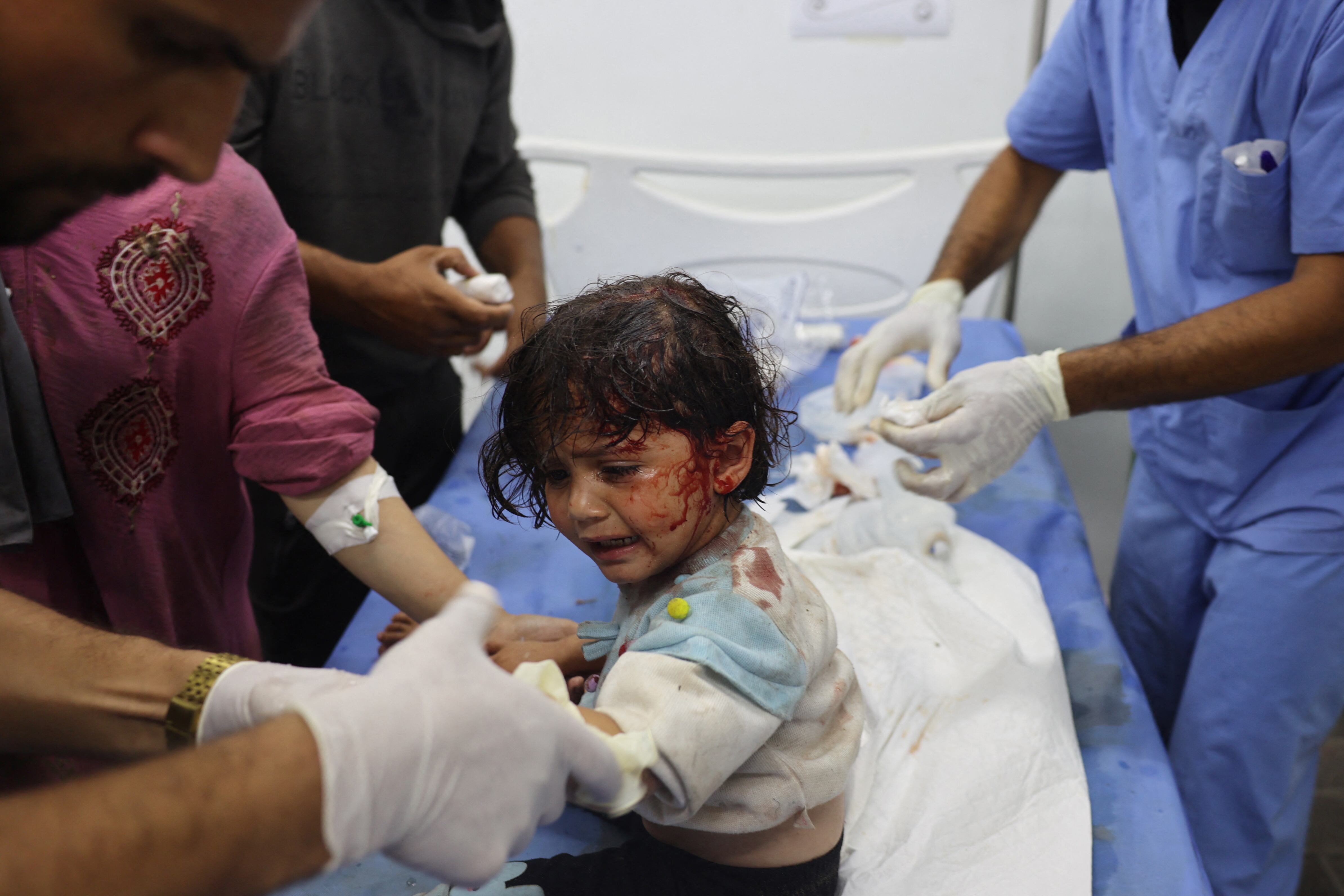 Una niña palestina, herida en un ataque de Israel contra un campo para desplazados de Gaza, recibe tratamiento en un hospital de Rafah el 26 de mayo de 2024. (Foto de Eyad BABA / AFP).