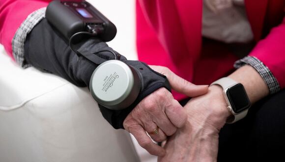 La empresa GyroGlove asegura que este guante es el estabilizador de mano más avanzado. (Foto: AFP)