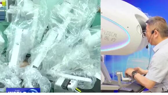 Telecirugía a 8.000 km de distancia: cirujano en Roma opera la próstata de un paciente en China. (Foto: CGTN Europe)