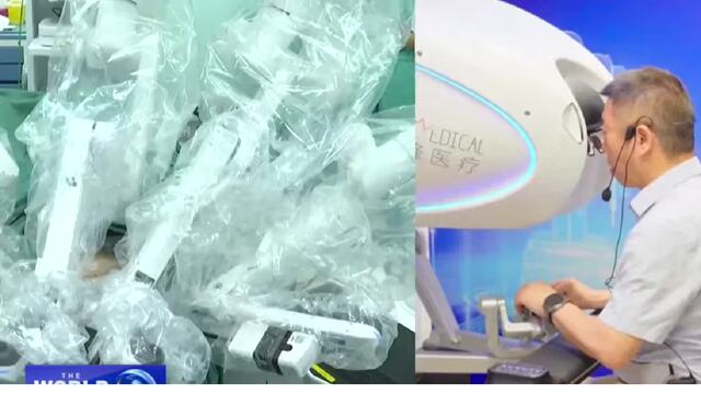 Telecirugía a 8.000 km de distancia: cirujano en Roma opera la próstata de un paciente en China