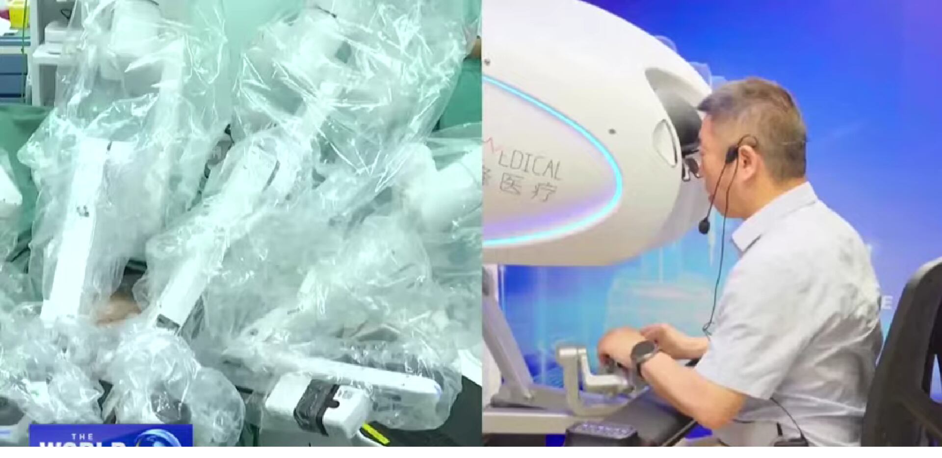 Telecirugía a 8.000 km de distancia: cirujano en Roma opera la próstata de un paciente en China. (Foto: CGTN Europe)