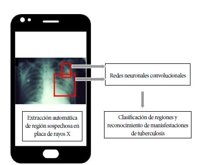 Enfoque propuesto para el análisis de imágenes de rayos X. (Foto: Difusión)