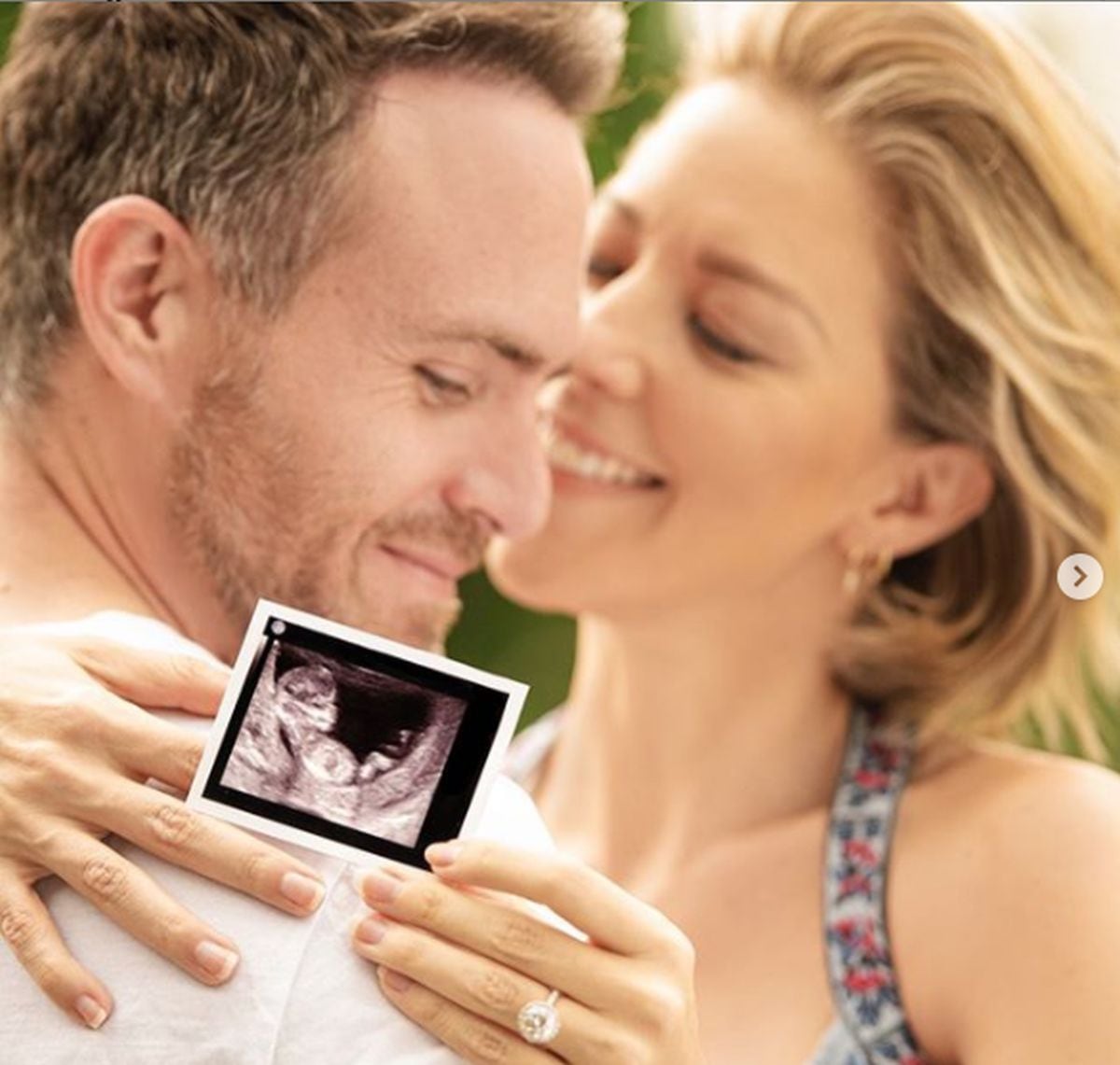 Foto que compartieron Fernanda y Erik para dar a conocer que están esperando su primer bebé (Foto: Fernanda Castillo / Instagram)