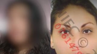 Joven quedó con el rostro desfigurado tras ser atacada por expareja de su enamorado | VIDEO 
