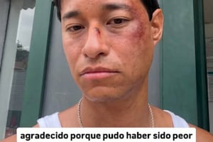 Tony Succar aparece con moretones y preocupa a sus seguidores: “Pudo haber sido peor”