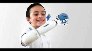 Diseñan una prótesis infantil compatible con Legos