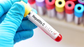 ¿Qué es la hepatitis y cómo prevenirla?