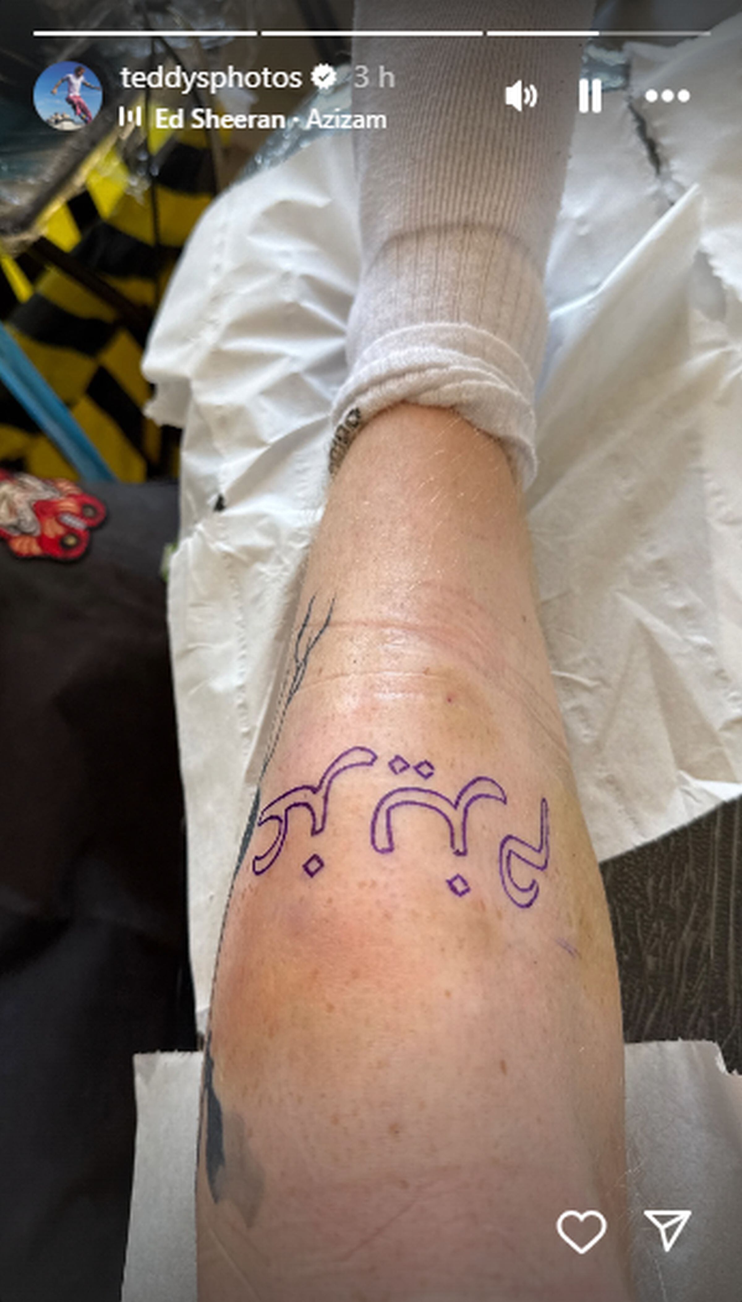 Ed Sheeran reveló, a través de Instagram Stories, que decidió hacerse un nuevo tatuaje. Esta vez en su pierna izquierda. (Foto: @teddysphotos / Instagram)