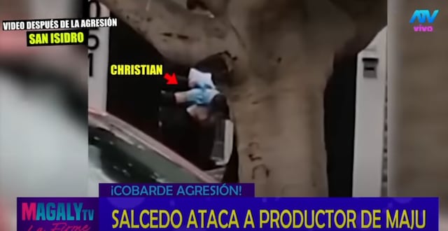 Christian Rodríguez siendo vendado por paramédicos tras la golpiza de Gustavo Salcedo | Foto: Magaly TV (Captura)