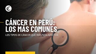 ¿Cuáles son los tipos de cáncer que más afectan a los peruanos?