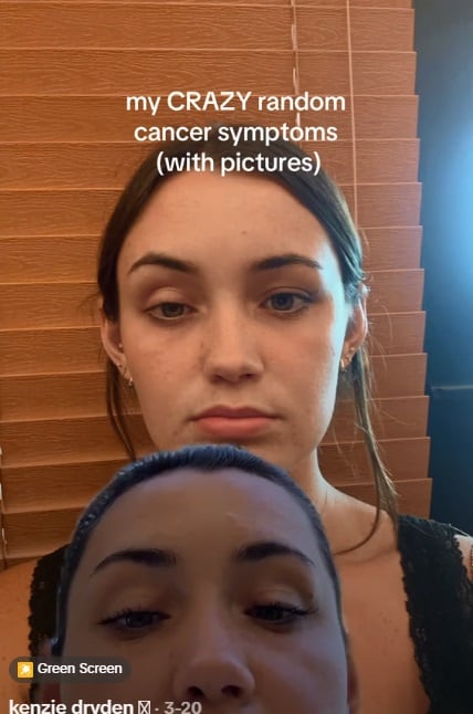 La primera señal de que algo no iba bien fue un detalle extraño que notó en su rostro: su ojo derecho no se abría por completo. (Foto: @kenzdryd)