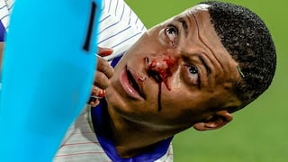 Ensangrentado: así quedó la nariz de Mbappé durante el Francia vs Austria por Eurocopa | VIDEO