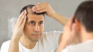Ni un solo pelo más: soluciona la caída de cabello con estos tratamientos | Interactivo