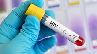 Una segunda persona con VIH podría haber eliminado el virus de su cuerpo sin tratamiento
