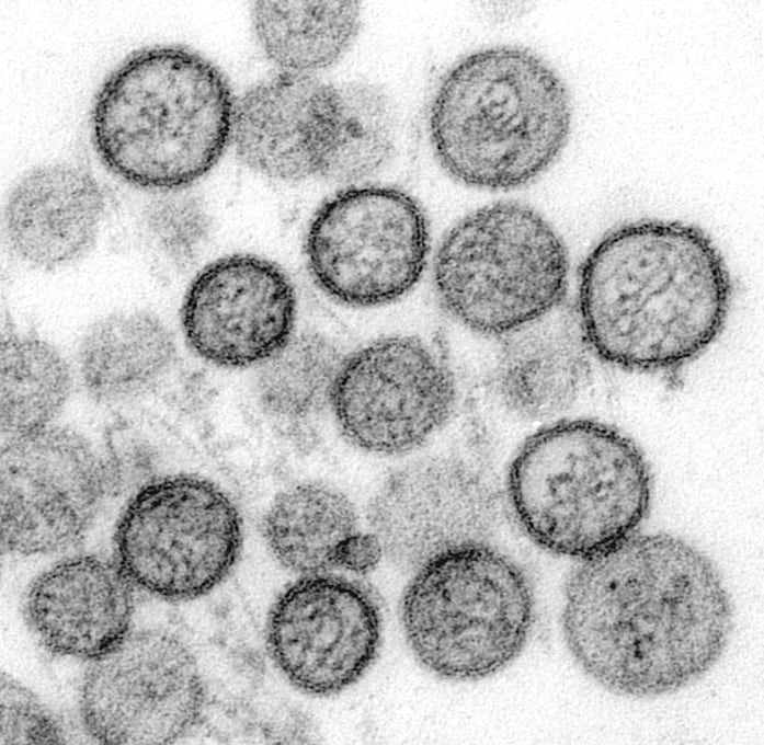 Foto: captura de un microscopio electrónico que muestra virus de la familia hantaviridae. (Cynthia Goldsmith 7 Centros para el Control y Prevención de Enfermedades de EE. UU.)