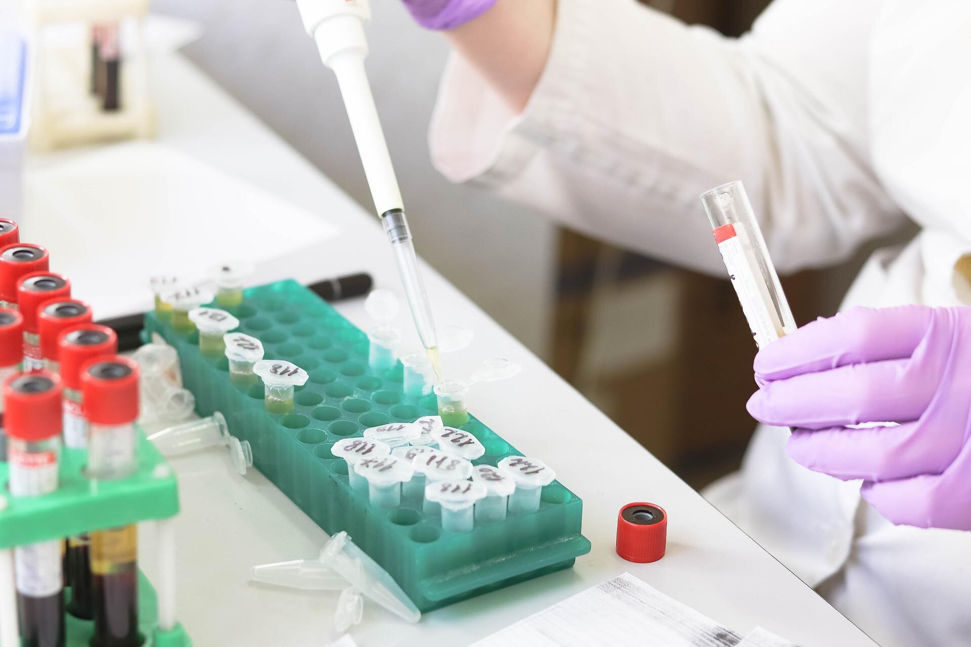 De presentar síntomas debes acudir al médico (Foto: Pixabay).