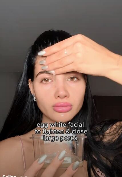 Según los expertos, no hay evidencia científica que respalde el uso de clara de huevo cruda como tratamiento facial. (Foto: @selinadasilvaa)