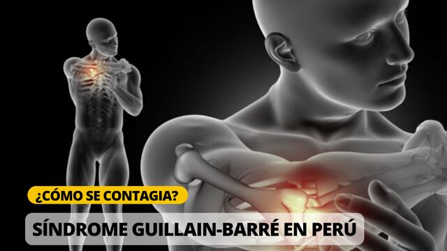 Últimas noticias del síndrome Guillain-Barré este, 5 de agosto