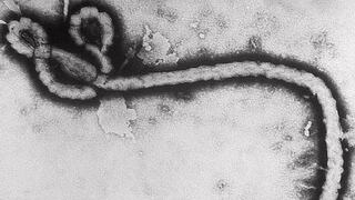Ébola: 10 datos para conocer mejor este virus