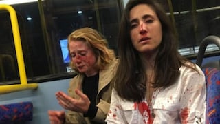 Cinco detenidos por ataque homófobo a lesbianas en un autobús en Londres