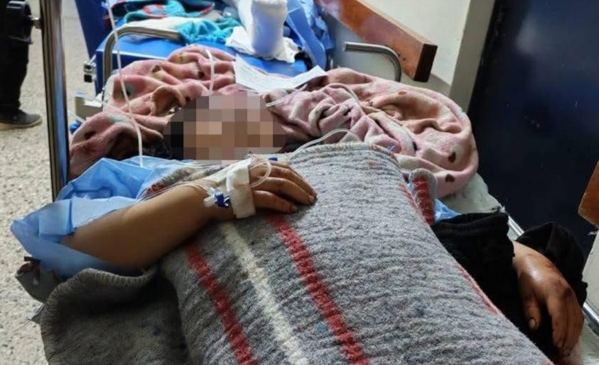 Hospital de Camaná atendió a 24 heridos tras accidente en Arequipa